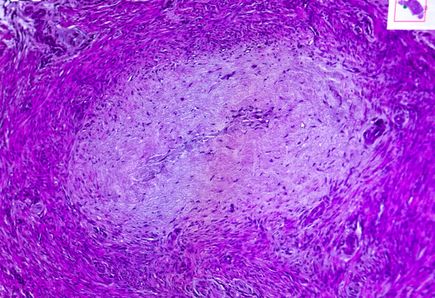 Research Week: Jeffrey Jensen, M.D., M.P.H.