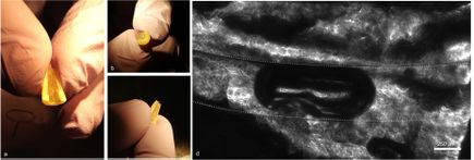 New research on root canal treatment