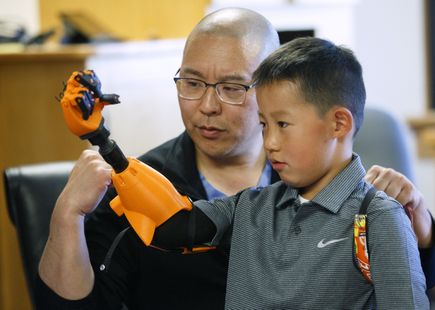 3D printed assistive device