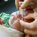 Retinopathy of prematurity (ROP)
