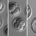 Study verifies gene repair breakthrough