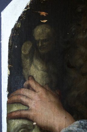 Revel: During treatment detail