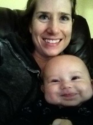 Hydrocephalus: Four days post surgery