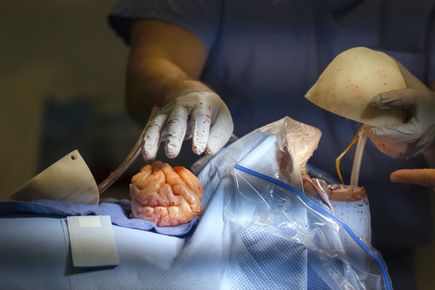 Brain surgery simulator