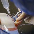 Brain surgery education, training ‘radically’ advances in U.S.