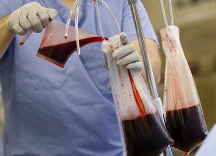 Brain surgery simulator