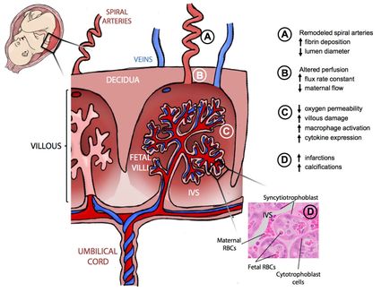 Zika placenta illustration