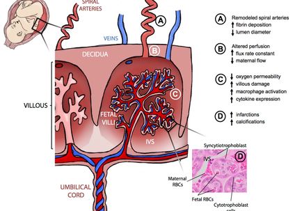 Zika placenta illustration