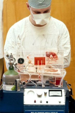 Kidney transplant milestone