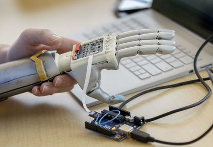 Bionic arm clinical trial