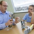 Bionic arm clinical trial