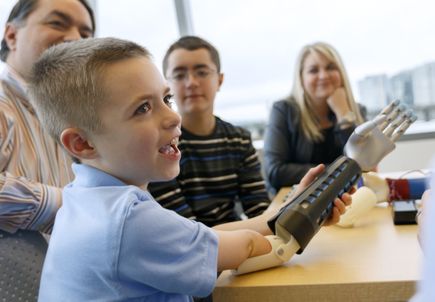 Bionic arm clinical trial
