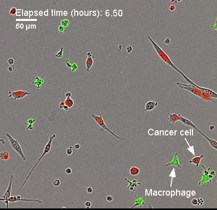 Cancer cell fusing with macrophage