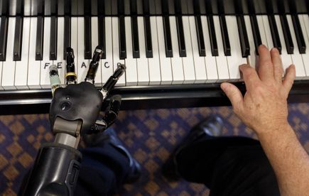 Thought-controlled bionic arm