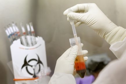 Malaria vaccine research