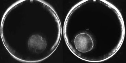 VIDEO DOWNLOAD: Excluded cellular fragments left and blastomeres right