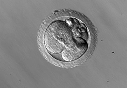 Rhesus embryo cellular fragmentation