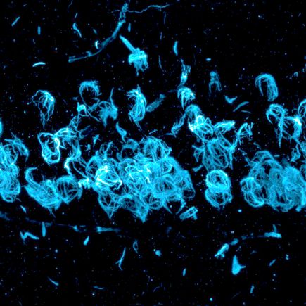 Parkinson's research