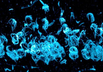 Parkinson's research