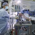 Awake craniotomy with language mapping