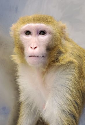 Bardet-Biedl syndrome