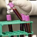 Blood samples
