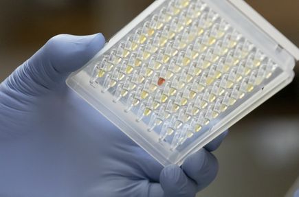 COVID-19 antibody testing