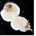 Hairy, lab-grown human skin cell model could advance hair loss research