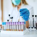 New injection could prevent HIV in nonhuman primates