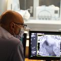 New treatment for tremors: Cutting-edge brain surgery with no cutting