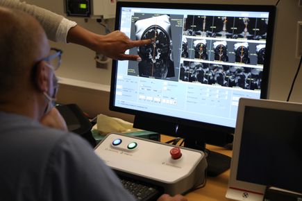 New treatment for tremors: Cutting-edge brain surgery with no cutting