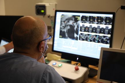 New treatment for tremors: Cutting-edge brain surgery with no cutting