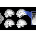 Astronaut Brain Fig.  1