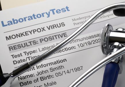 OHSU monkeypox expert advises vigilance