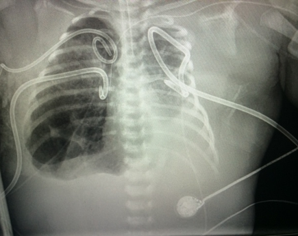 FetalTherapy_Vignery3