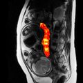 OHSU researchers develop new imaging method to detect complications early in pregnancy