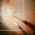 Nanotechnology may improve gene therapy for blindness