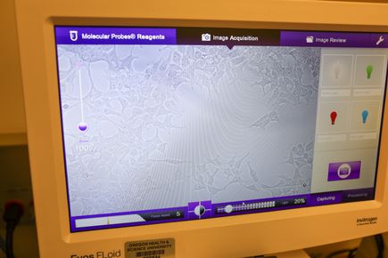 Una vista de microscopio de las clulas iniciadoras de un tumor utilizadas en el laboratorio de Cohen