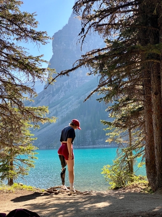 Rebecca Johnston by the lake on a sunny day. “Cancer is a terrible thing to have,” Rebecca Johnston says. “But you’ve got to move forward. You’ve got to lean into it. I kept a positive outlook. It helped my body heal. You take it one day at a time. Sometimes you take it one hour at a time.” She went on a camping trip in Canada in 2022. (Photo courtesy of Rebecca Johnston)