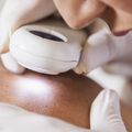 Melanoma detection