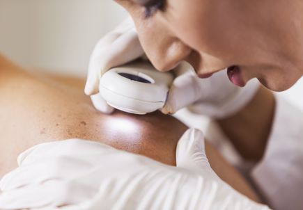 Melanoma detection