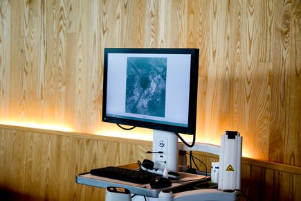 Dermatlogos de OHSU detectan el cancer de piel ms pequeo del mundo 2