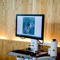 Dermatlogos de OHSU detectan el cancer de piel ms pequeo del mundo 2