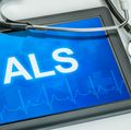 El estudio propone la posibilidad de utilizar un tratamiento de inmunoterapia para la ELA