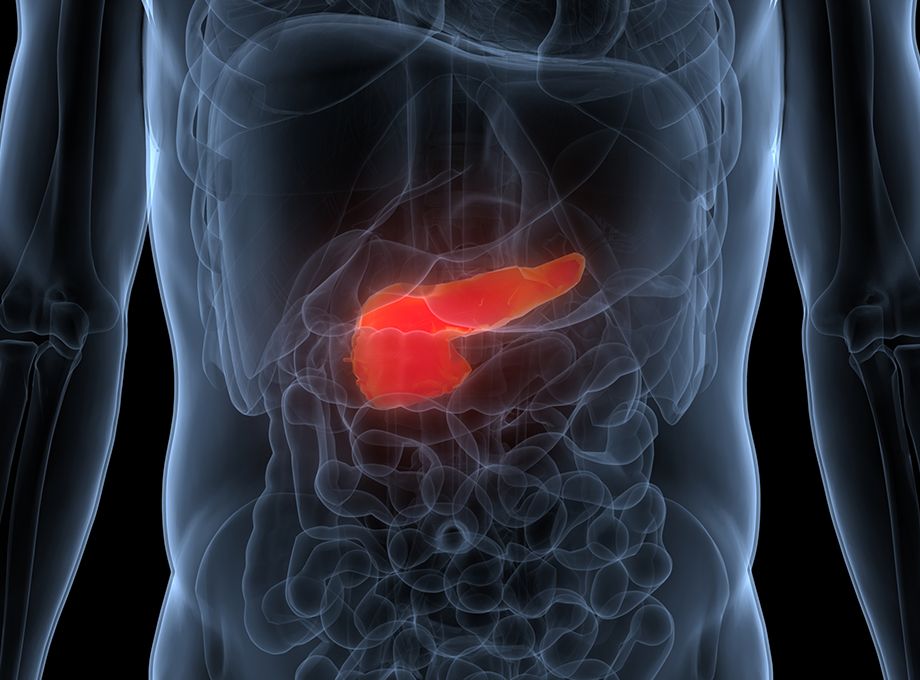 Gracias a un enfoque innovador para la detección temprana del cáncer, investigadores de Oregon Health & Science University reciben una subvención de $3.8 millones. El equipo ahora además es miembro del consorcio para la detección de cáncer de páncreas del National Cancer Institute. (Getty Images)