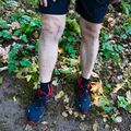 OHSU patient after receiving and implantable shock absorber