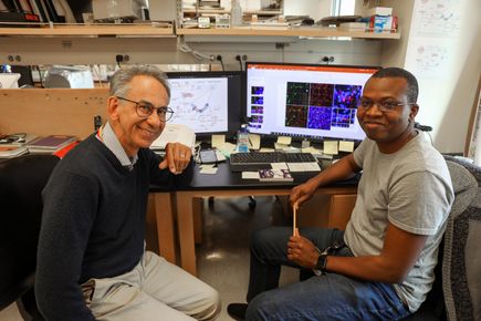 Cientficos de OHSU descubren nueva causa de la enfermedad de Alzheimer y la demencia vascular
