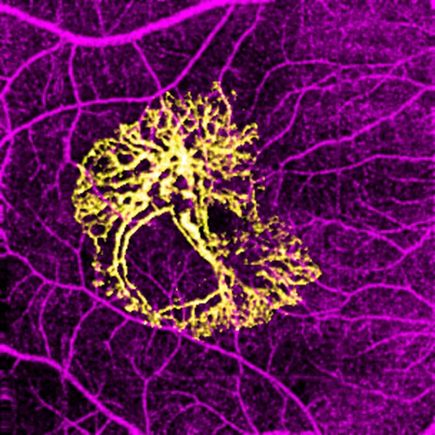 Optical coherence tomography angiography