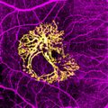 Optical coherence tomography angiography