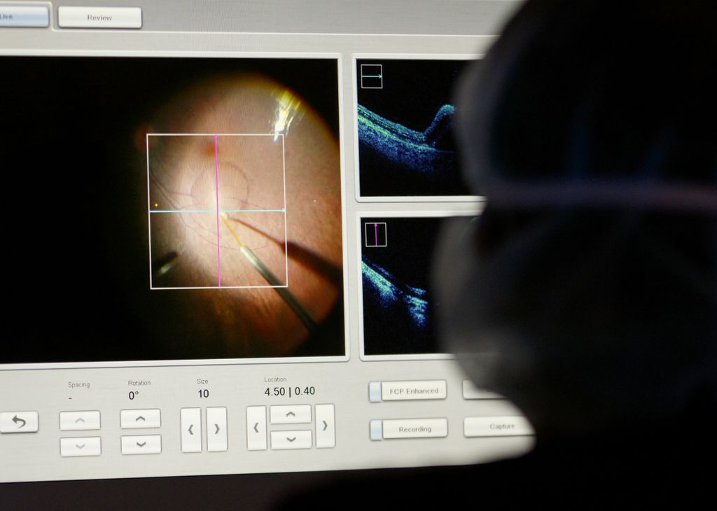 The Luxturna treatment is injected into Caspian Soto's eye. Soto was among first in Oregon to have new treatment for rare, blindness-causing genetic mutation, September 17, 2018 at the OHSU Casey Eye Institute, which is home to both comprehensive eye care and top researchers developing the next generation of treatments for many eye conditions. (OHSU)